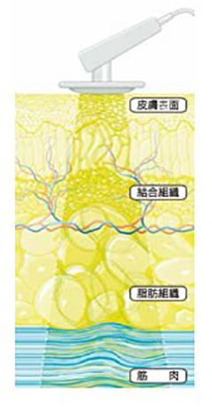 機械が常に患者と対話しながら治療を行います